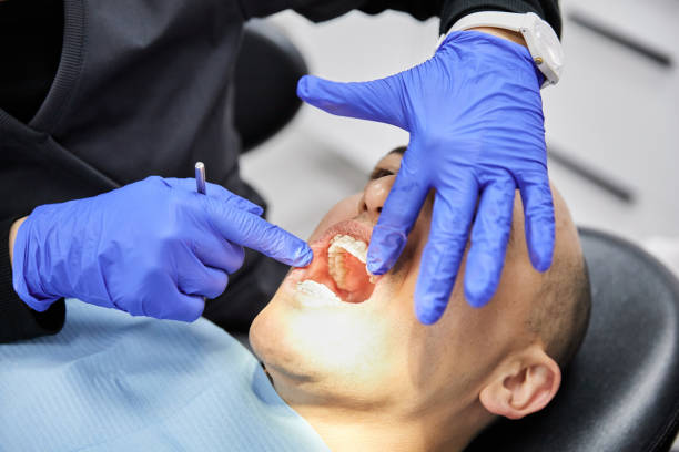 Best Tooth Infection Emergency Dentist  in Milam, TX